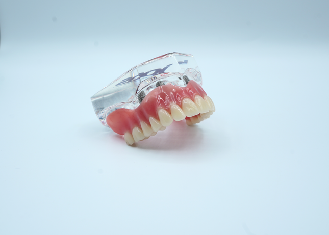 4 Implant Upper Overdenture Jaw Model