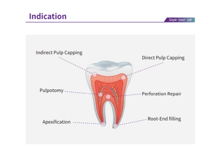 EndoCem Root Repair MTA Premix in a syringe, 2g