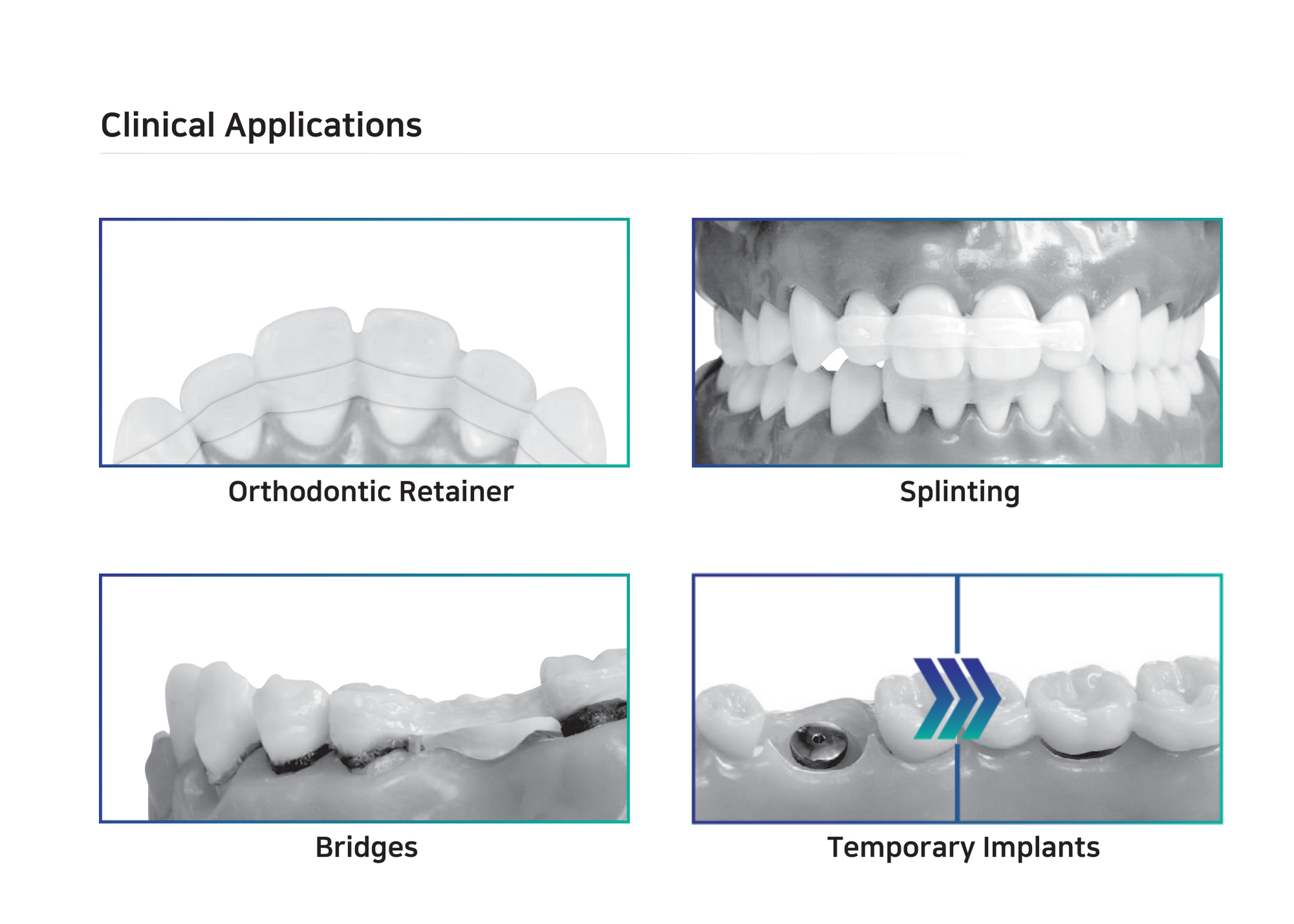 Dental Fiber Splint, High-Quality Surgical Tools - OsseoShop