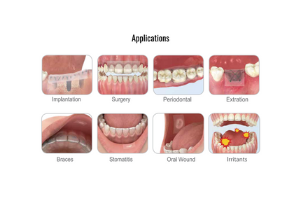 Ora-Aid: Oral Bandage