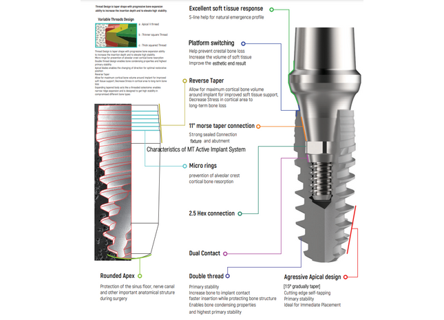 I DO Dental Implant Details