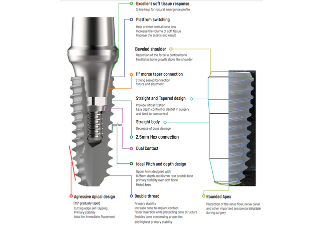 I DO S Dental Implant Details